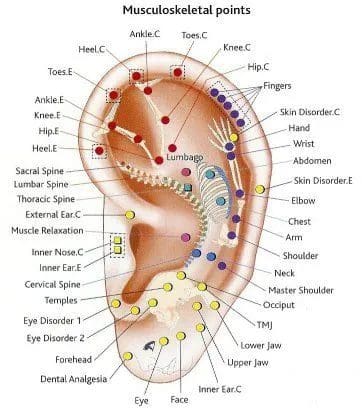 Ear acupuncture musculoskeletal points diagram.